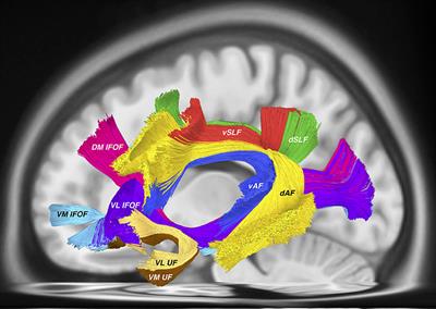 Commentary: The Nomenclature of Human White Matter Association Pathways: Proposal for a Systematic Taxonomic Anatomical Classification